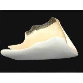 Sabot fibre de verre ZRX 1100/1200 SRT FAIRINGS